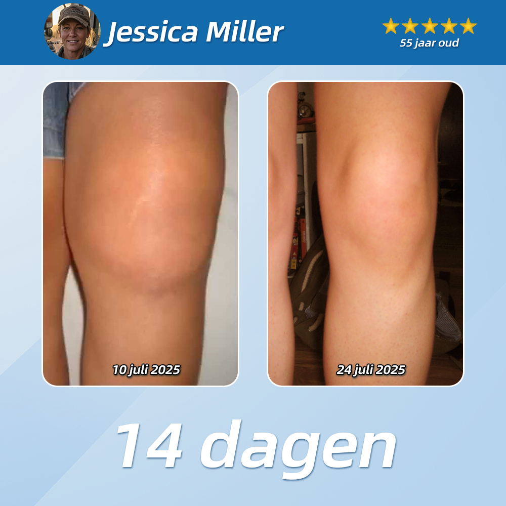 [Nieuwjaarsaanbieding] CureVivo® Pijnstillende &  herstellende lotion👨‍⚕️Voor spier-, gewrichts- en zenuwpijn
