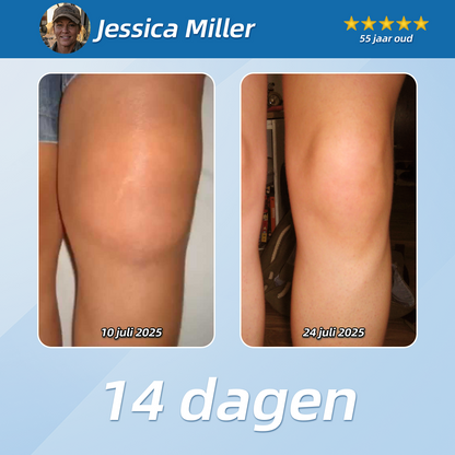 [Nieuwjaarsaanbieding] CureVivo® Pijnstillende &  herstellende lotion👨‍⚕️Voor spier-, gewrichts- en zenuwpijn