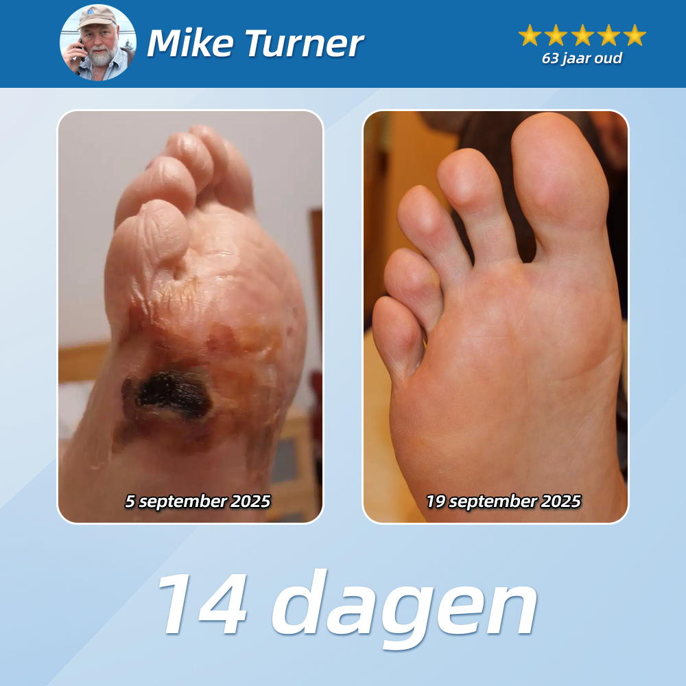 [Nieuwjaarsaanbieding] CureVivo® Pijnstillende &  herstellende lotion👨‍⚕️Voor spier-, gewrichts- en zenuwpijn