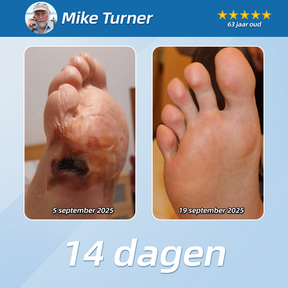 [Nieuwjaarsaanbieding] CureVivo® Pijnstillende &  herstellende lotion👨‍⚕️Voor spier-, gewrichts- en zenuwpijn